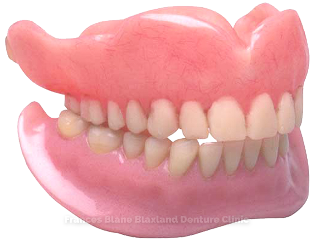 complete or full dentures