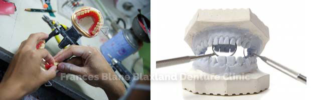 denture repair and relining