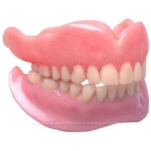 full or complete dentures
