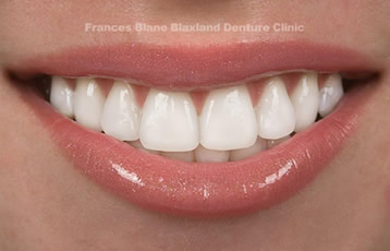 Blaxland Penrith Denture Clinic